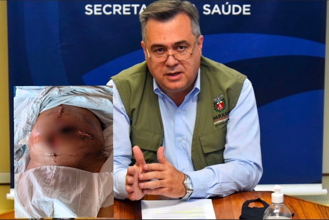 Secretário Beto Preto é criticado após buscar atendimento em hospital particular no Litoral