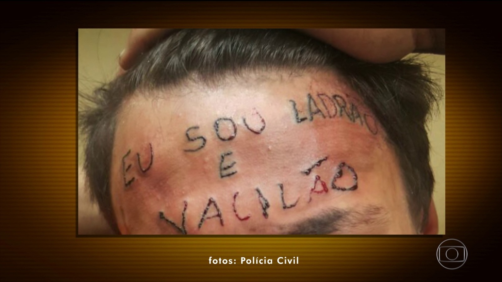 Ruan Rocha e a recidiva criminal: Jovem da tatuagem na testa é preso novamente em São Paulo